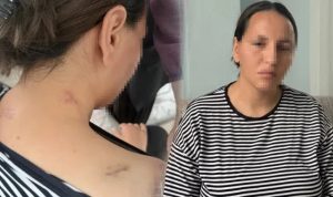Korumayan Bir Uzaklaştırma Daha… Havva 17 Bıçak Darbesinden ‘Ölü Numarası’ ile Kurtuldu