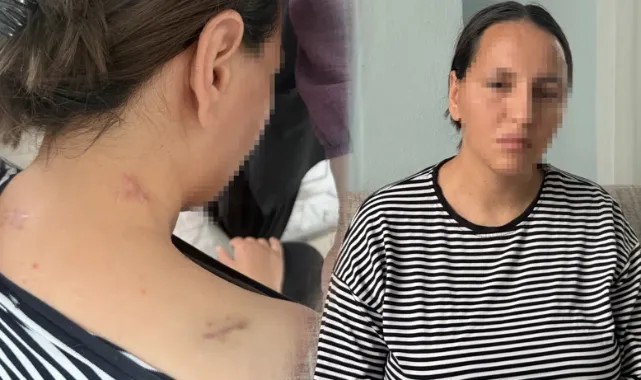 Korumayan Bir Uzaklaştırma Daha… Havva 17 Bıçak Darbesinden ‘Ölü Numarası’ ile Kurtuldu